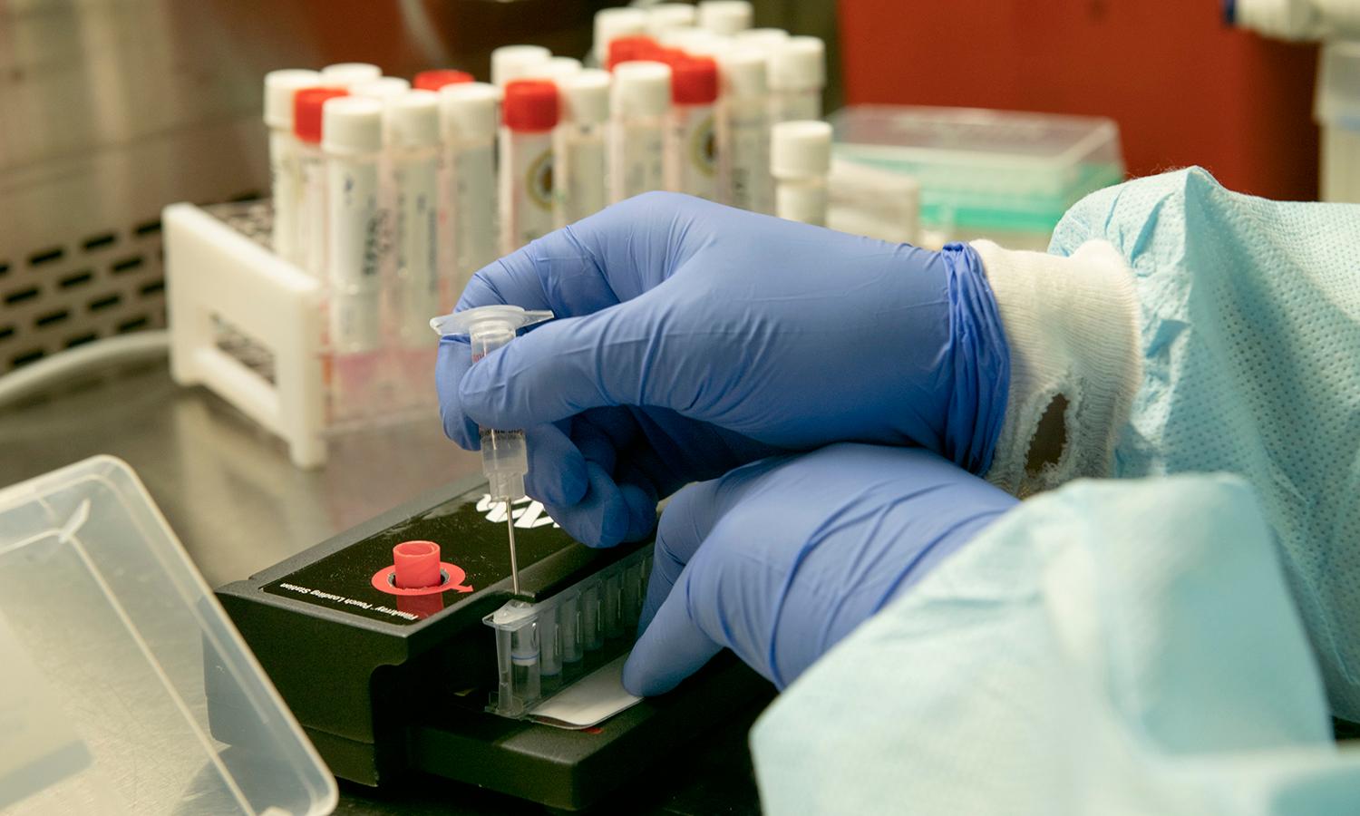 Medical personnel prepares samples for testing