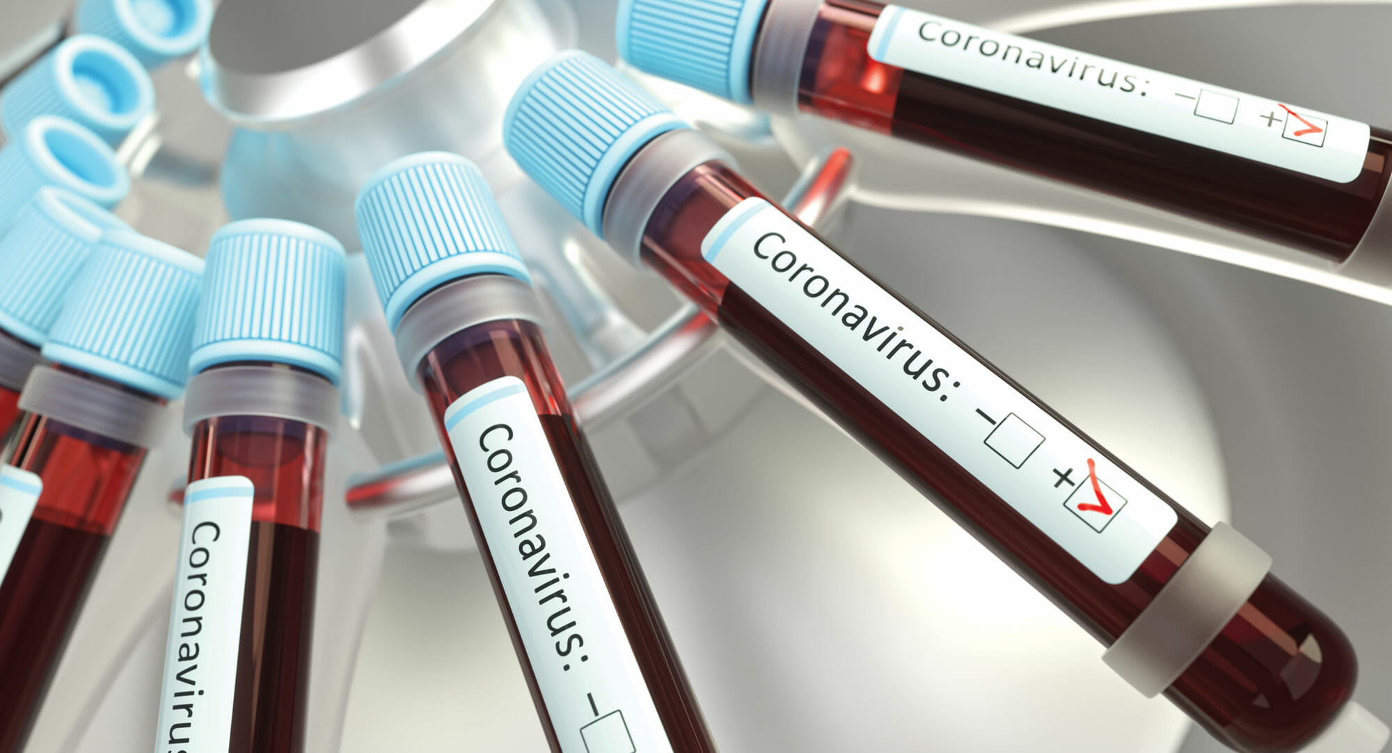 Coronavirus turns up the heat on cybersecurity projects